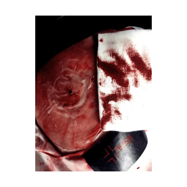 Opatrunek wentylowy Chest Seal Vented